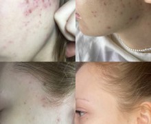 Секрет красоты – в правильном уходе!